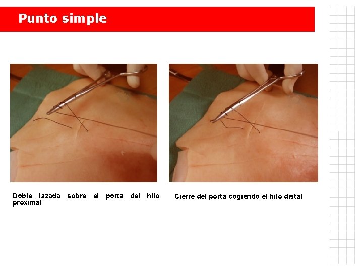 Punto simple Doble lazada sobre el porta del hilo proximal Cierre del porta cogiendo