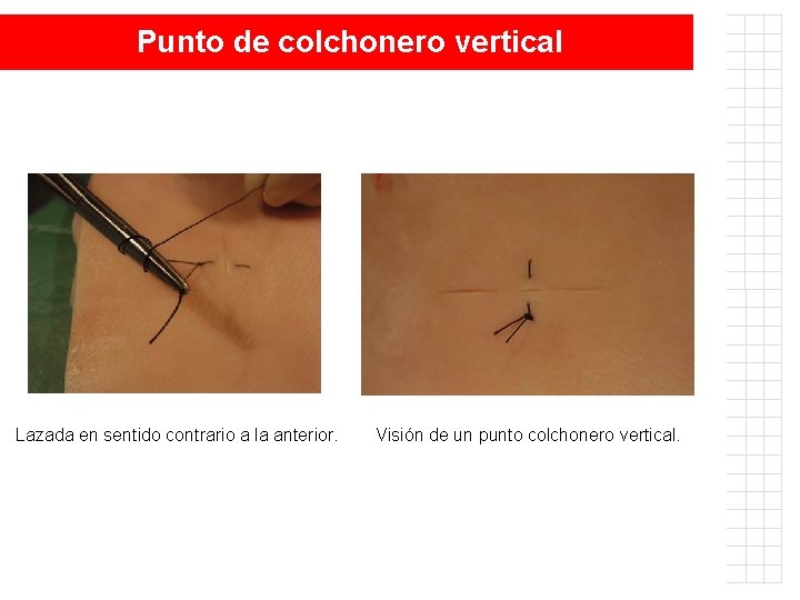 Punto de colchonero vertical Lazada en sentido contrario a la anterior. Visión de un