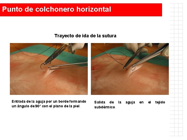 Punto de colchonero horizontal Trayecto de ida de la sutura Entrada de la aguja