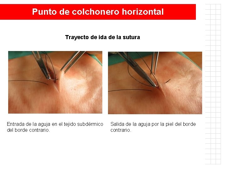 Punto de colchonero horizontal Trayecto de ida de la sutura Entrada de la aguja