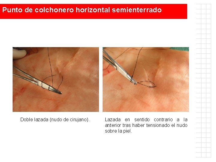 Punto de colchonero horizontal semienterrado Doble lazada (nudo de cirujano). Lazada en sentido contrario