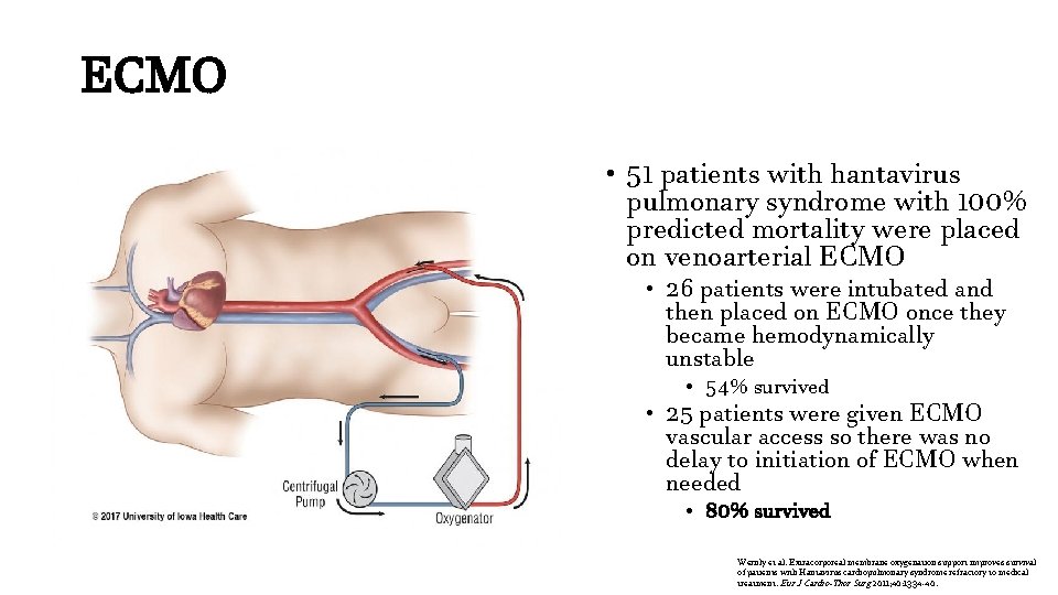 ECMO • 51 patients with hantavirus pulmonary syndrome with 100% predicted mortality were placed