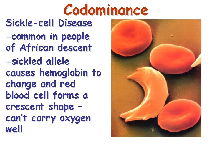 Codominance Sickle-cell Disease -common in people of African descent -sickled allele causes hemoglobin to