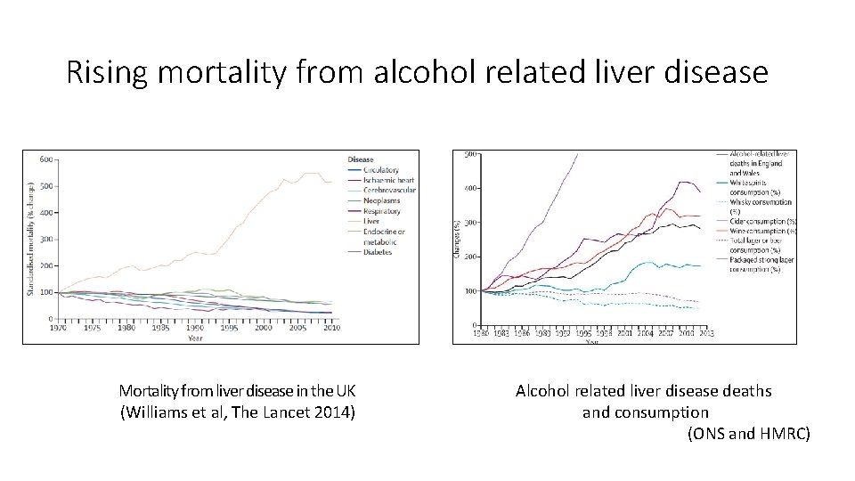 Rising mortality from alcohol related liver disease Mortality from liver disease in the UK