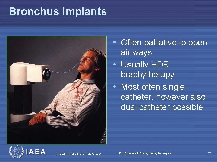 Bronchus implants • Often palliative to open air ways • Usually HDR brachytherapy •