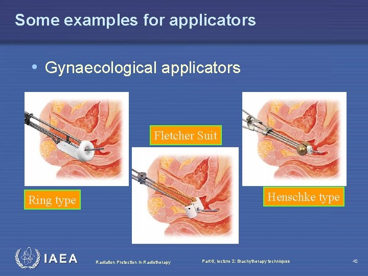 Some examples for applicators • Gynaecological applicators Fletcher Suit Henschke type Ring type Radiation