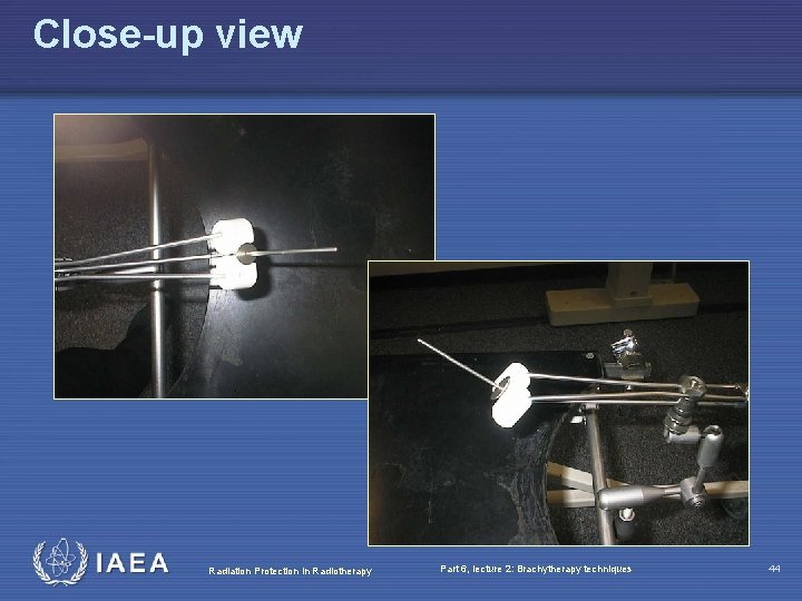 Close-up view Radiation Protection in Radiotherapy Part 6, lecture 2: Brachytherapy techniques 44 