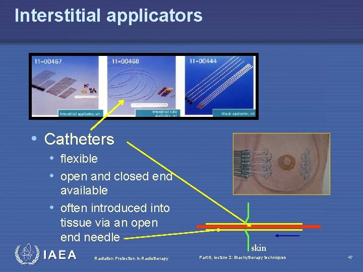 Interstitial applicators • Catheters • flexible • open and closed end available • often