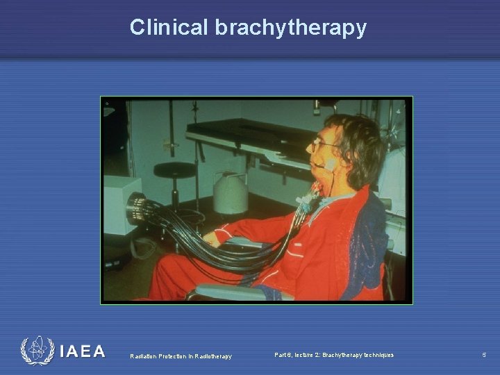 Clinical brachytherapy Radiation Protection in Radiotherapy Part 6, lecture 2: Brachytherapy techniques 5 