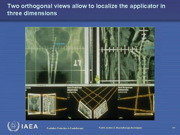 Two orthogonal views allow to localize the applicator in three dimensions Radiation Protection in