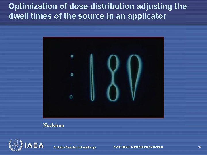 Optimization of dose distribution adjusting the dwell times of the source in an applicator