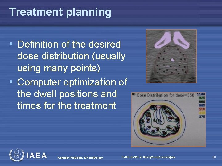 Treatment planning • Definition of the desired dose distribution (usually using many points) •