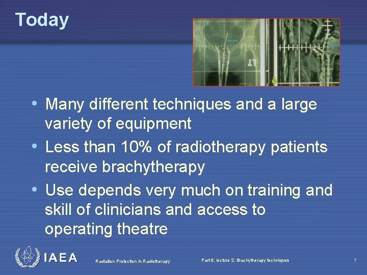 Today • Many different techniques and a large variety of equipment • Less than