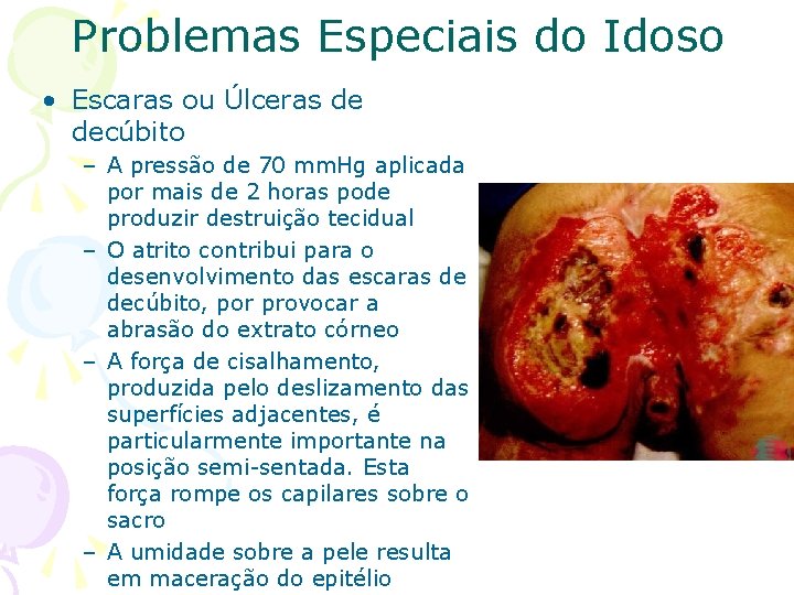 Problemas Especiais do Idoso • Escaras ou Úlceras de decúbito – A pressão de