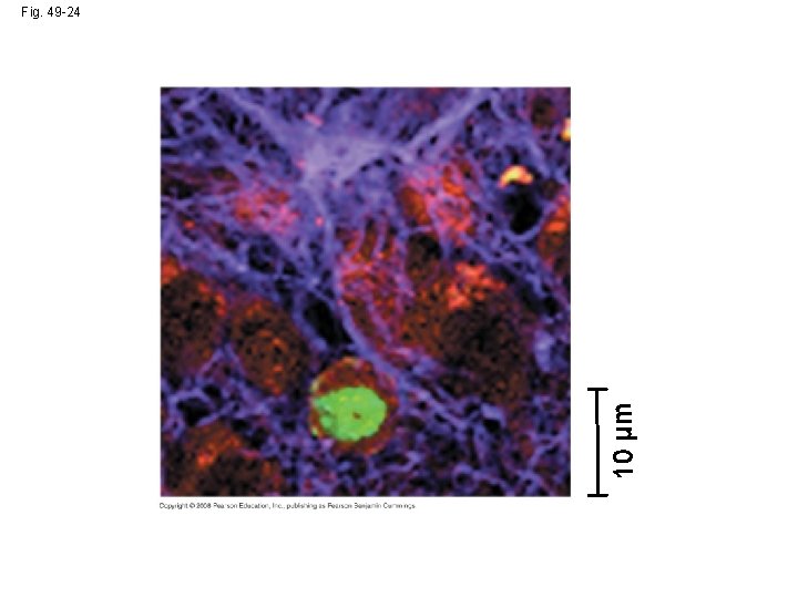 10 µm Fig. 49 -24 