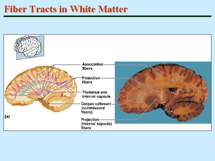 Fiber Tracts in White Matter 