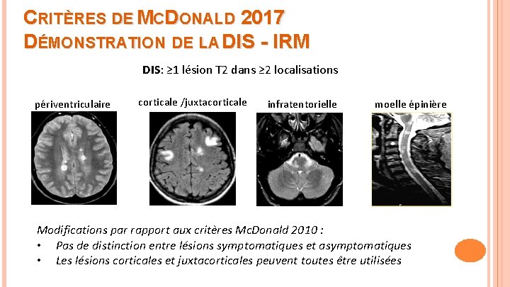 CRITÈRES DE MCDONALD 2017 DÉMONSTRATION DE LA DIS - IRM DIS: ≥ 1 lésion
