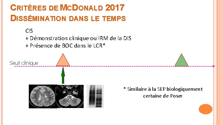 CRITÈRES DE MCDONALD 2017 DISSÉMINATION DANS LE TEMPS CIS + Démonstration clinique ou IRM