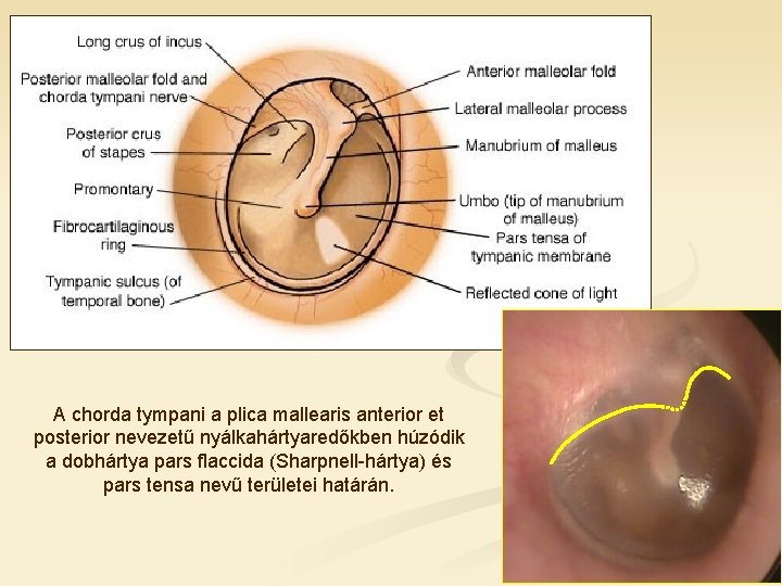 A chorda tympani a plica mallearis anterior et posterior nevezetű nyálkahártyaredőkben húzódik a dobhártya