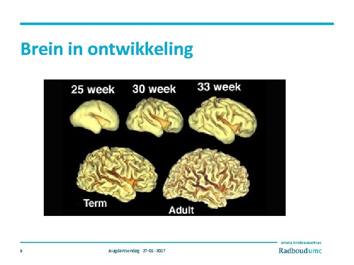 Brein in ontwikkeling Amalia Kinderziekenhuis 9 Jeugdartsendag 27 -01 -2017 