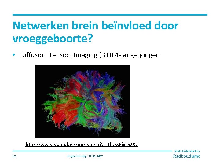 Netwerken brein beïnvloed door vroeggeboorte? • Diffusion Tension Imaging (DTI) 4 -jarige jongen http: