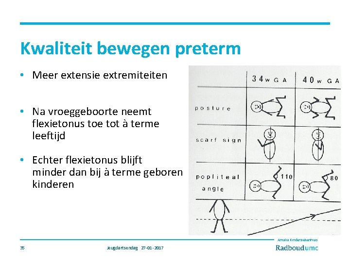 Kwaliteit bewegen preterm • Meer extensie extremiteiten • Na vroeggeboorte neemt flexietonus toe tot