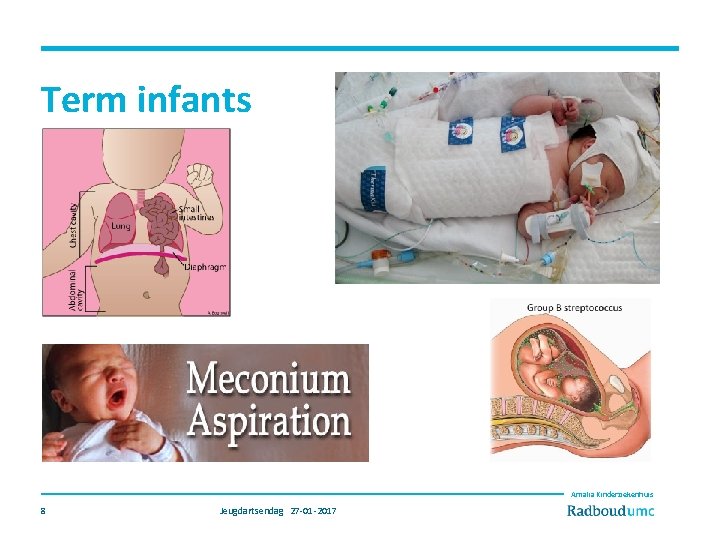 Term infants Amalia Kinderziekenhuis 8 Jeugdartsendag 27 -01 -2017 