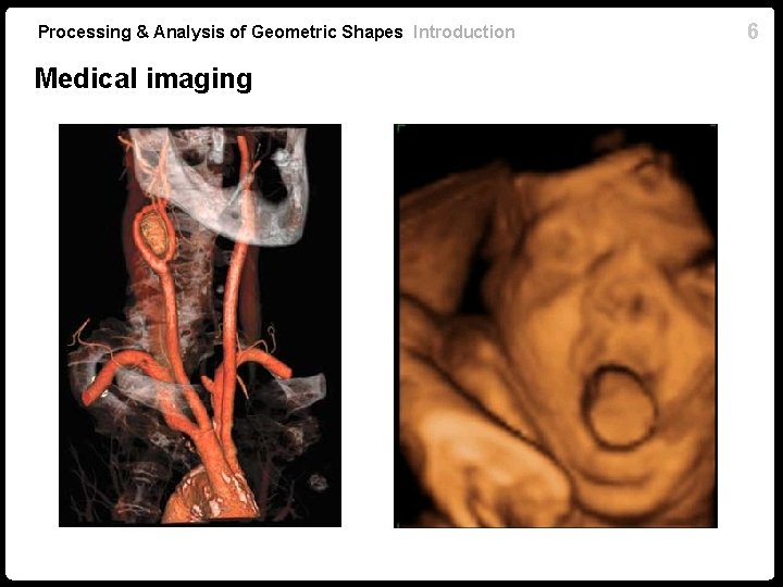 Processing & Analysis of Geometric Shapes Introduction Medical imaging 6 