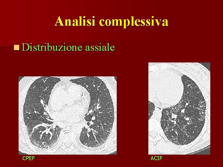 Analisi complessiva n Distribuzione assiale CPEF ACIF 