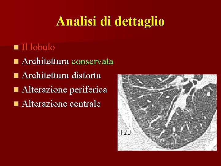 Analisi di dettaglio n Il lobulo n Architettura conservata n Architettura distorta n Alterazione