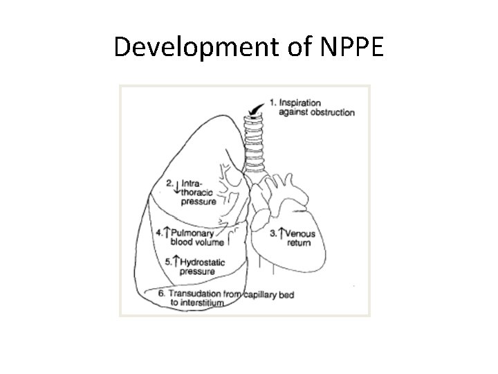 Development of NPPE 