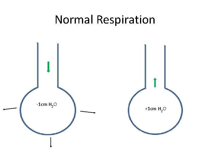 Normal Respiration -1 cm H 2 O +1 cm H 2 O 