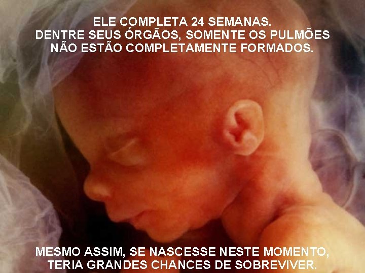 ELE COMPLETA 24 SEMANAS. DENTRE SEUS ÓRGÃOS, SOMENTE OS PULMÕES NÃO ESTÃO COMPLETAMENTE FORMADOS.