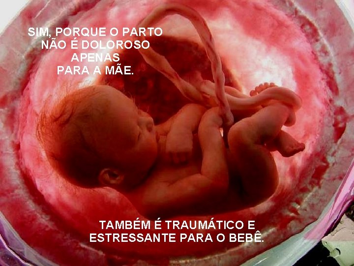 SIM, PORQUE O PARTO NÃO É DOLOROSO APENAS PARA A MÃE. TAMBÉM É TRAUMÁTICO