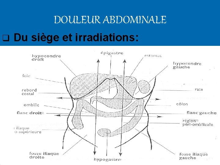 DOULEUR ABDOMINALE q Du siège et irradiations: 
