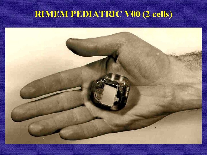 RIMEM PEDIATRIC V 00 (2 cells) 