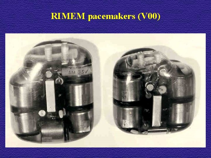 RIMEM pacemakers (V 00) 