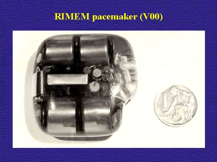 RIMEM pacemaker (V 00) 