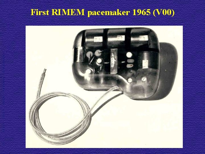 First RIMEM pacemaker 1965 (V 00) 