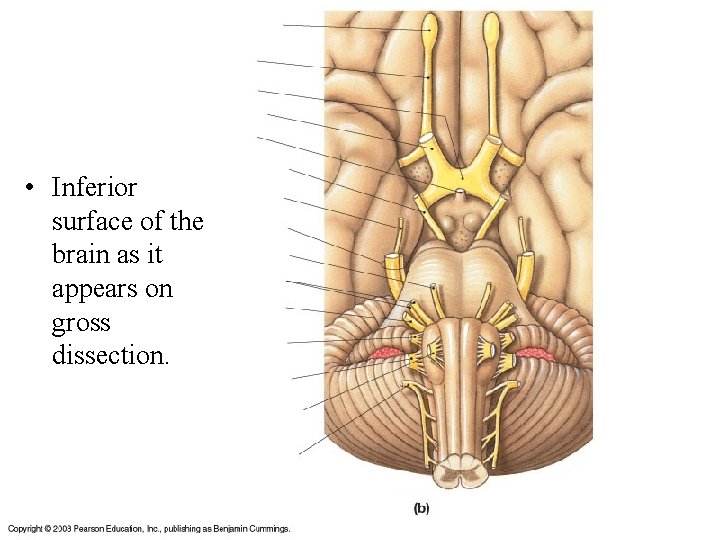 • Inferior surface of the brain as it appears on gross dissection. 