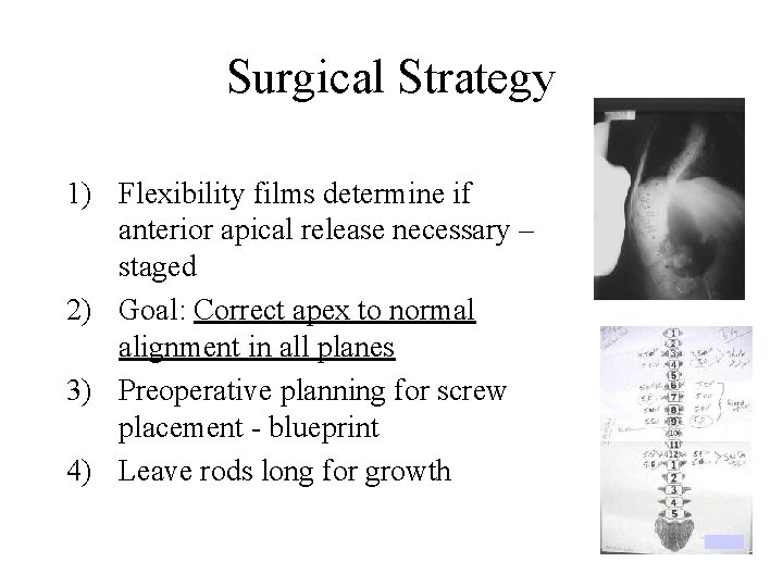 Surgical Strategy 1) Flexibility films determine if anterior apical release necessary – staged 2)