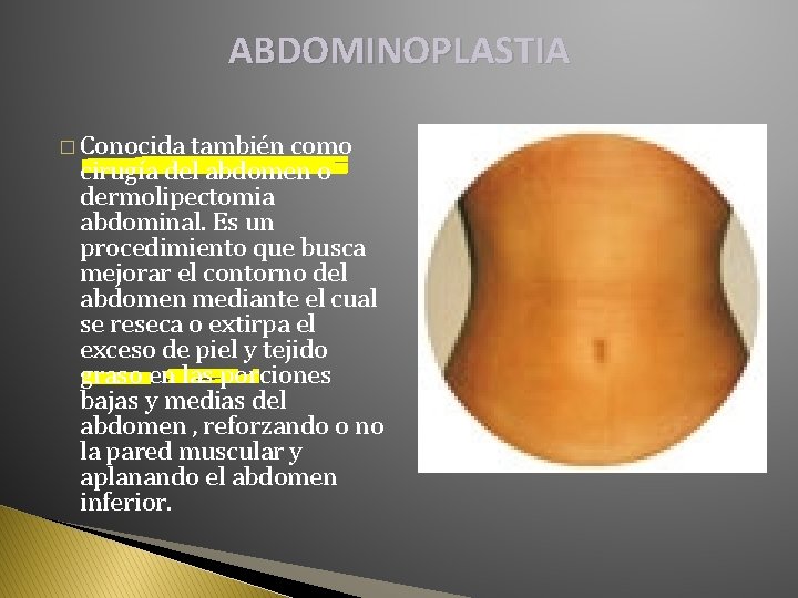 ABDOMINOPLASTIA � Conocida también como cirugía del abdomen o dermolipectomia abdominal. Es un procedimiento