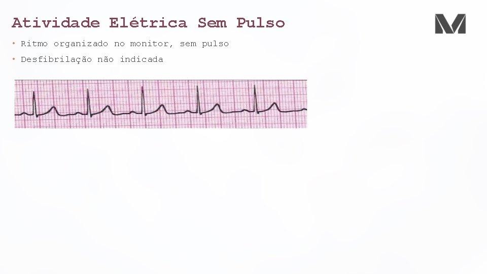 Atividade Elétrica Sem Pulso • Ritmo organizado no monitor, sem pulso • Desfibrilação não