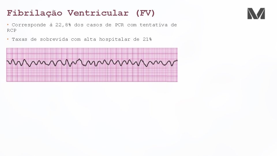 Fibrilação Ventricular (FV) • Corresponde à 22, 8% dos casos de PCR com tentativa