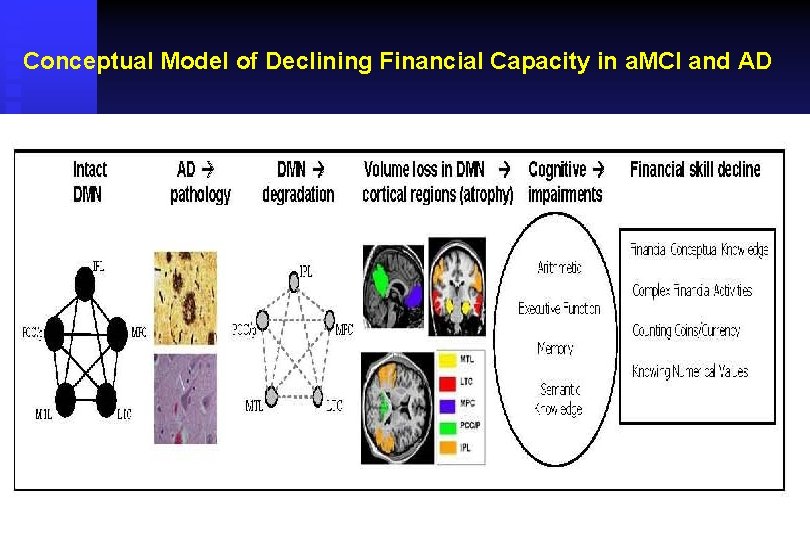 Conceptual Model of Declining Financial Capacity in a. MCI and AD Conceptual Model of Declining Financial Capacity in a. MCI and AD