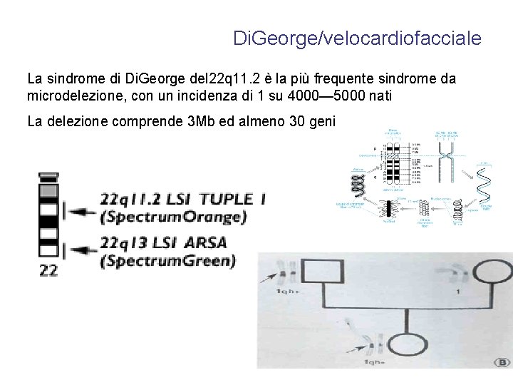 Di. George/velocardiofacciale La sindrome di Di. George del 22 q 11. 2 è la