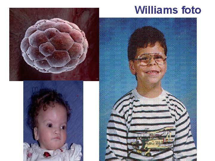 Williams foto 