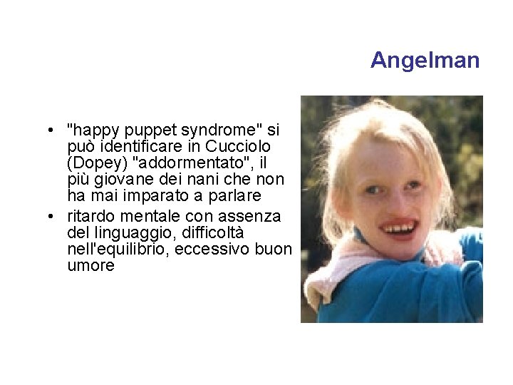 Angelman • "happy puppet syndrome" si può identificare in Cucciolo (Dopey) "addormentato", il più