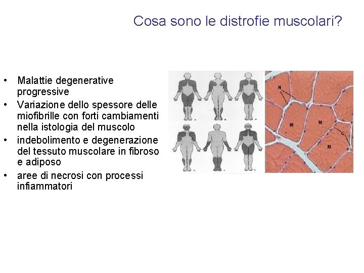 Cosa sono le distrofie muscolari? • Malattie degenerative progressive • Variazione dello spessore delle