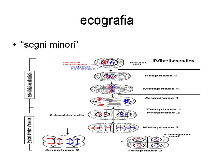 ecografia • “segni minori” 